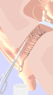 挖耳朵模拟器 1.0.0截图2