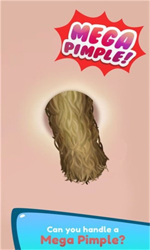 Mega Pimple Popper 1.0.0截图2 Mega Pimple Popper 1.0.0截图2