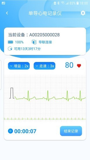 星康心电截图3 星康心电截图3